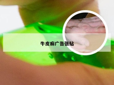 牛皮癣广告张贴