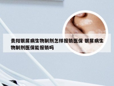 贵阳银屑病生物制剂怎样报销医保 银屑病生物制剂医保能报销吗
