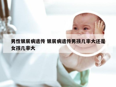 男性银屑病遗传 银屑病遗传男孩几率大还是女孩几率大