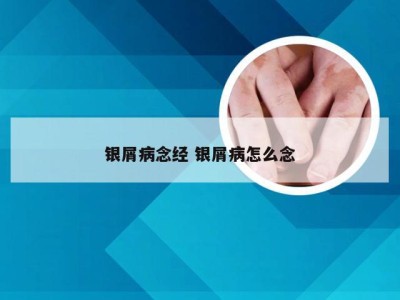 银屑病念经 银屑病怎么念