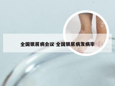 全国银屑病会议 全国银屑病发病率