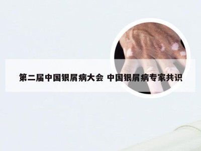 第二届中国银屑病大会 中国银屑病专家共识