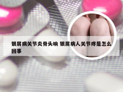 银屑病关节炎骨头响 银屑病人关节疼是怎么回事
