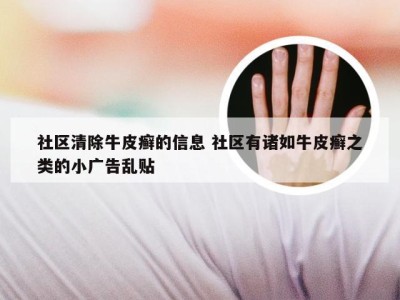 社区清除牛皮癣的信息 社区有诸如牛皮癣之类的小广告乱贴