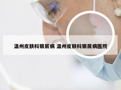 温州皮肤科银屑病 温州皮肤科银屑病医院
