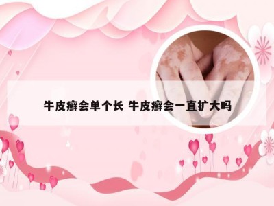 牛皮癣会单个长 牛皮癣会一直扩大吗