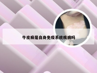 牛皮癣是自身免疫系统疾病吗