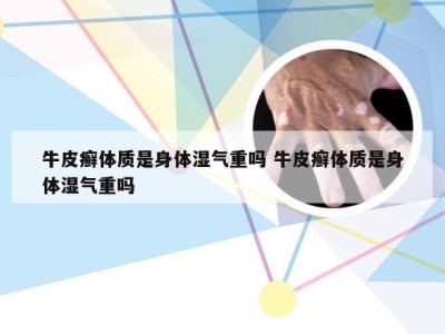 牛皮癣体质是身体湿气重吗 牛皮癣体质是身体湿气重吗