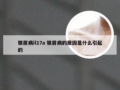 银屑病il17a 银屑病的原因是什么引起的