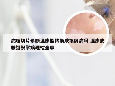 病理切片诊断湿疹能转换成银屑病吗 湿疹皮肤组织学病理检查单