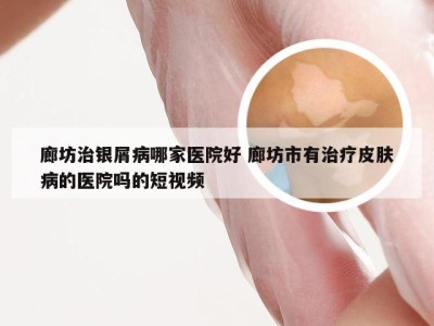 廊坊治银屑病哪家医院好 廊坊市有治疗皮肤病的医院吗的短视频