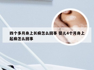 四个多月身上长癣怎么回事 婴儿4个月身上起癣怎么回事