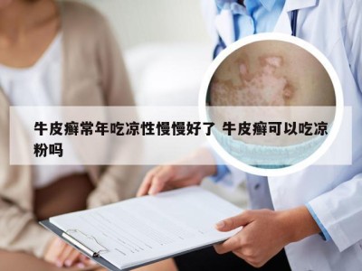 牛皮癣常年吃凉性慢慢好了 牛皮癣可以吃凉粉吗