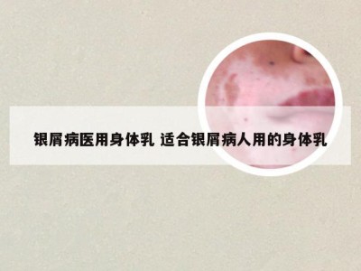 银屑病医用身体乳 适合银屑病人用的身体乳