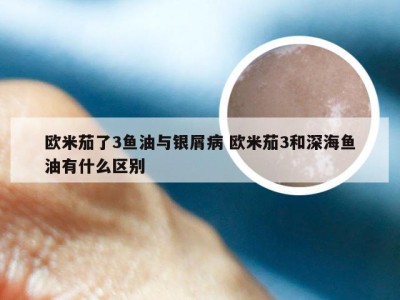 欧米茄了3鱼油与银屑病 欧米茄3和深海鱼油有什么区别