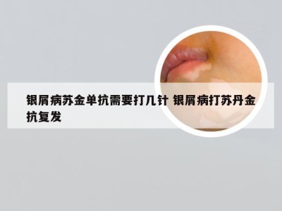 银屑病苏金单抗需要打几针 银屑病打苏丹金抗复发