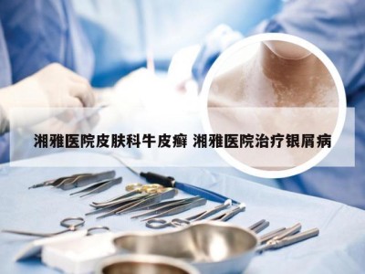 湘雅医院皮肤科牛皮癣 湘雅医院治疗银屑病