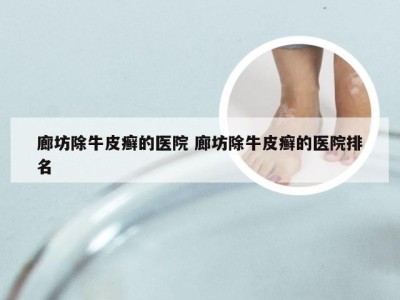 廊坊除牛皮癣的医院 廊坊除牛皮癣的医院排名