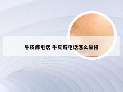 牛皮癣电话 牛皮癣电话怎么举报
