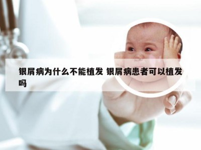 银屑病为什么不能植发 银屑病患者可以植发吗
