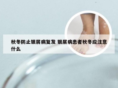 秋冬防止银屑病复发 银屑病患者秋冬应注意什么