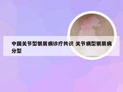 中国关节型银屑病诊疗共识 关节病型银屑病分型