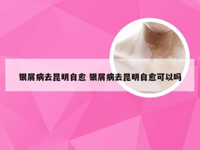 银屑病去昆明自愈 银屑病去昆明自愈可以吗