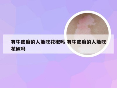 有牛皮癣的人能吃花椒吗 有牛皮癣的人能吃花椒吗
