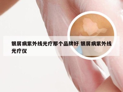 银屑病紫外线光疗那个品牌好 银屑病紫外线光疗仪