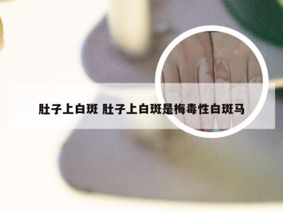 肚子上白斑 肚子上白斑是梅毒性白斑马