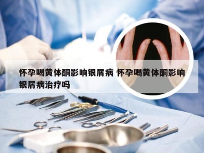 怀孕喝黄体酮影响银屑病 怀孕喝黄体酮影响银屑病治疗吗
