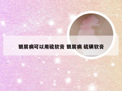 银屑病可以用硫软膏 银屑病 硫磺软膏