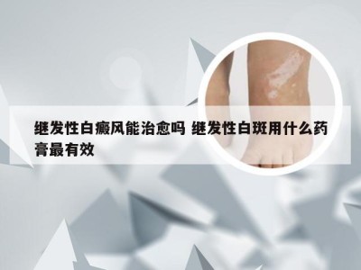 继发性白癜风能治愈吗 继发性白斑用什么药膏最有效