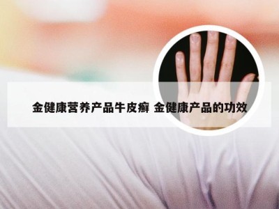 金健康营养产品牛皮癣 金健康产品的功效