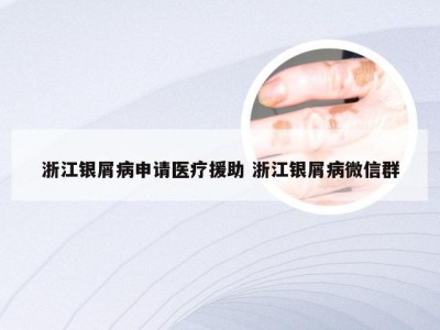 浙江银屑病申请医疗援助 浙江银屑病微信群