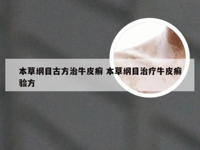 本草纲目古方治牛皮癣 本草纲目治疗牛皮癣验方