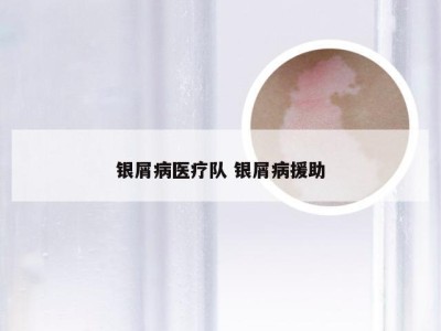 银屑病医疗队 银屑病援助