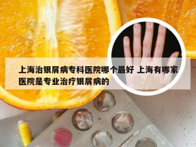 上海治银屑病专科医院哪个最好 上海有哪家医院是专业治疗银屑病的
