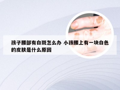 孩子腰部有白斑怎么办 小孩腰上有一块白色的皮肤是什么原因