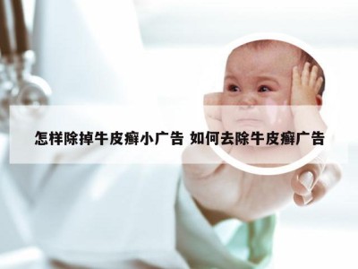 怎样除掉牛皮癣小广告 如何去除牛皮癣广告