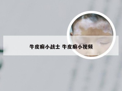牛皮癣小战士 牛皮癣小视频