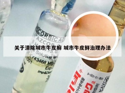 关于清除城市牛皮癣 城市牛皮鲜治理办法
