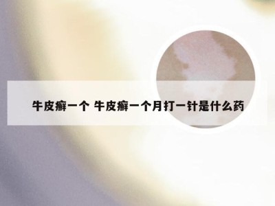 牛皮癣一个 牛皮癣一个月打一针是什么药