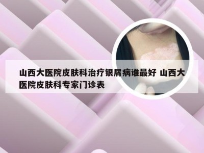 山西大医院皮肤科治疗银屑病谁最好 山西大医院皮肤科专家门诊表