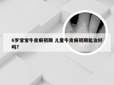 6岁宝宝牛皮癣初期 儿童牛皮癣初期能治好吗?