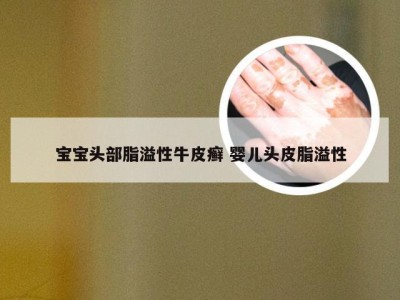 宝宝头部脂溢性牛皮癣 婴儿头皮脂溢性