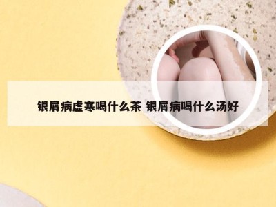 银屑病虚寒喝什么茶 银屑病喝什么汤好