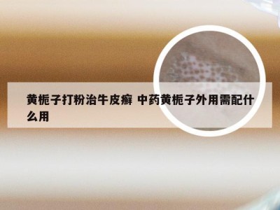 黄栀子打粉治牛皮癣 中药黄栀子外用需配什么用