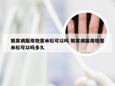 银屑病服用地塞米松可以吗 银屑病服用地塞米松可以吗多久