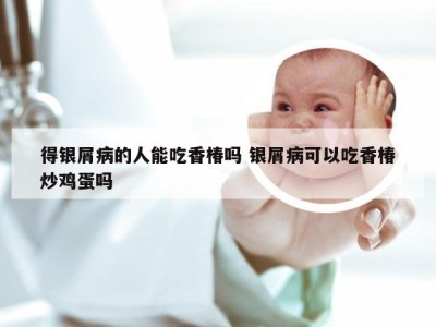 得银屑病的人能吃香椿吗 银屑病可以吃香椿炒鸡蛋吗
